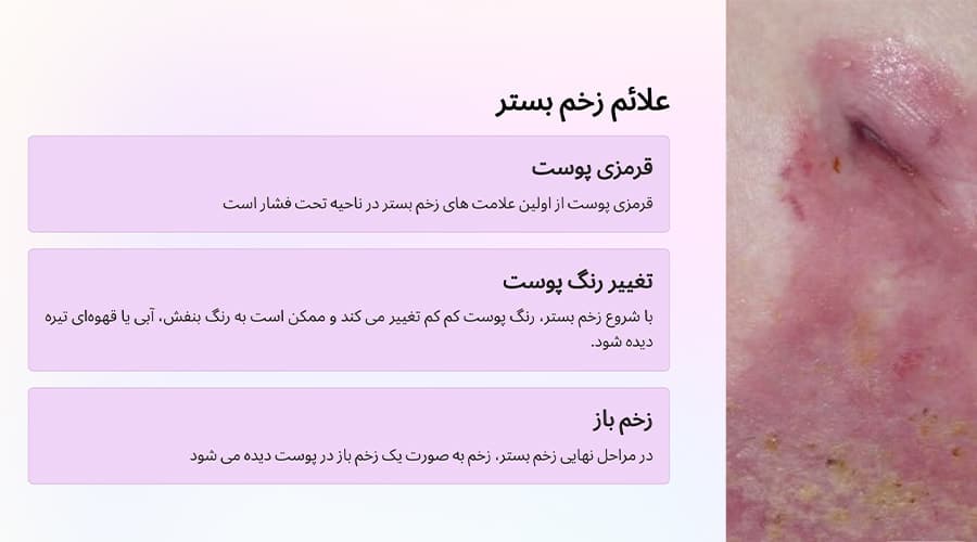 علائم زخم بستر