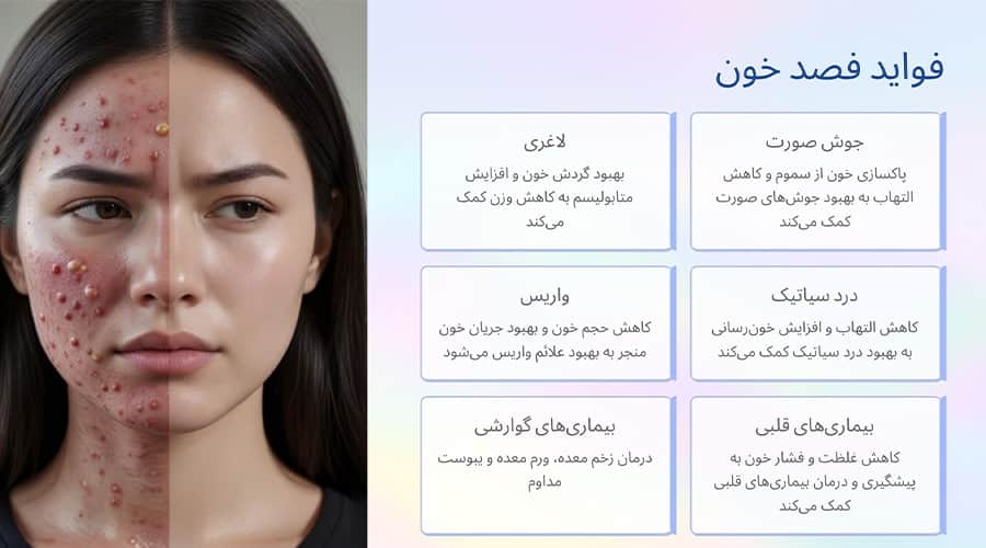 فواید فصد خون