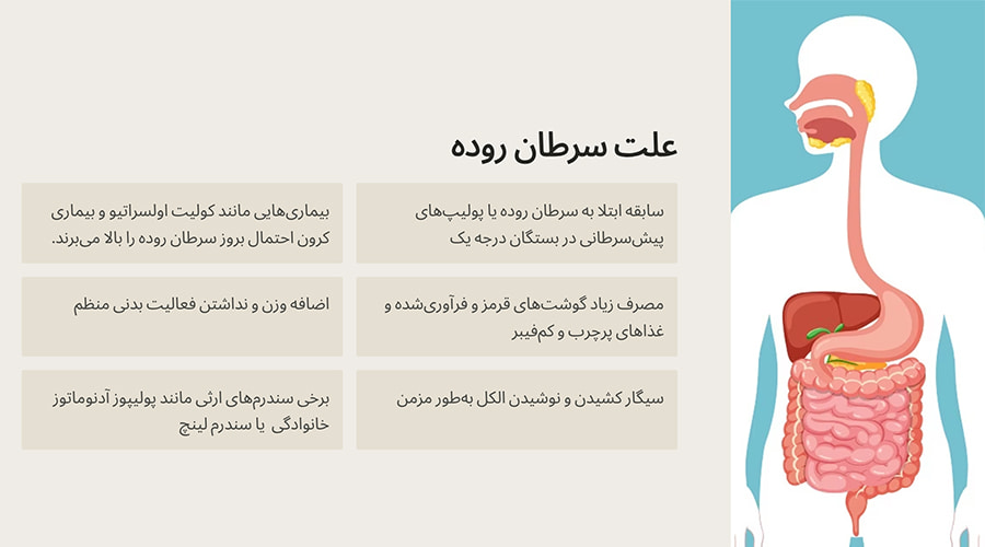 علت سرطان روده