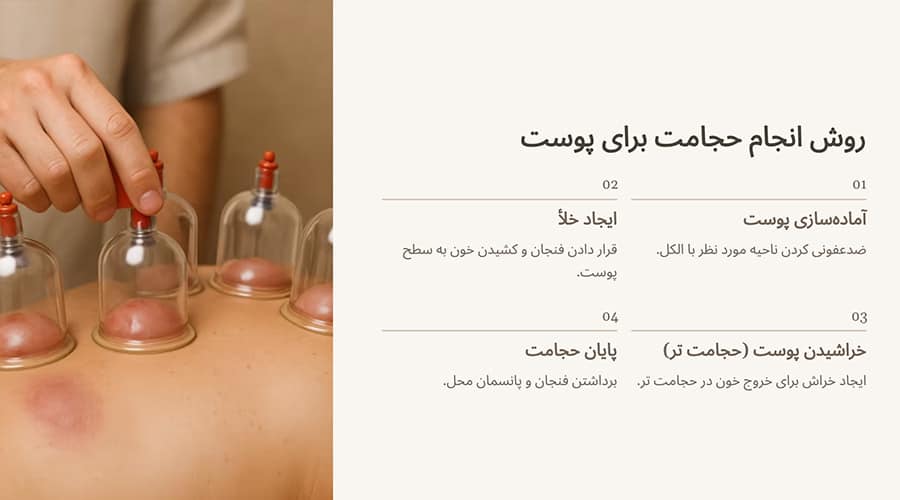 روش انجام حجامت برای پوست