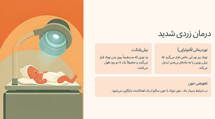 درمان زردی نوزاد