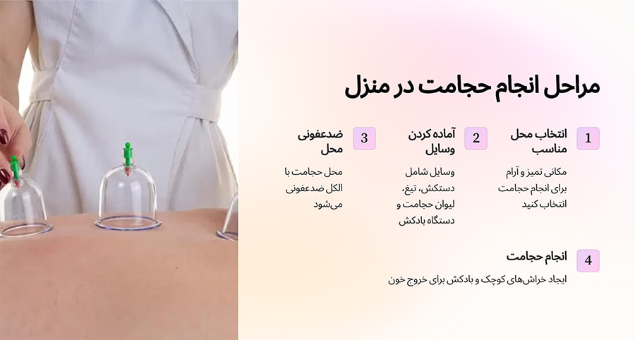 روش انجام حجامت در منزل