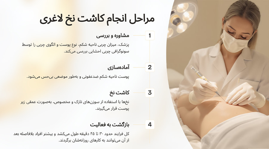 مراحل انجام کاشت نخ لاغری