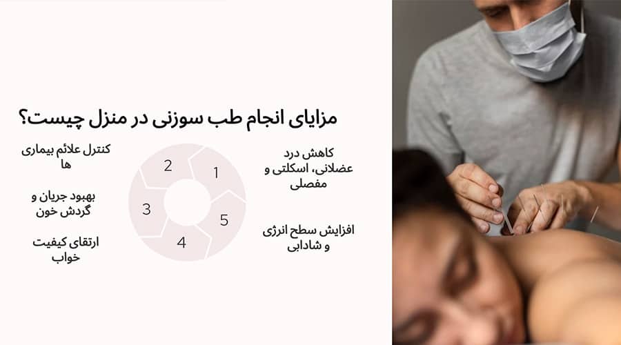 مزایای انجام طب سوزنی در منزل