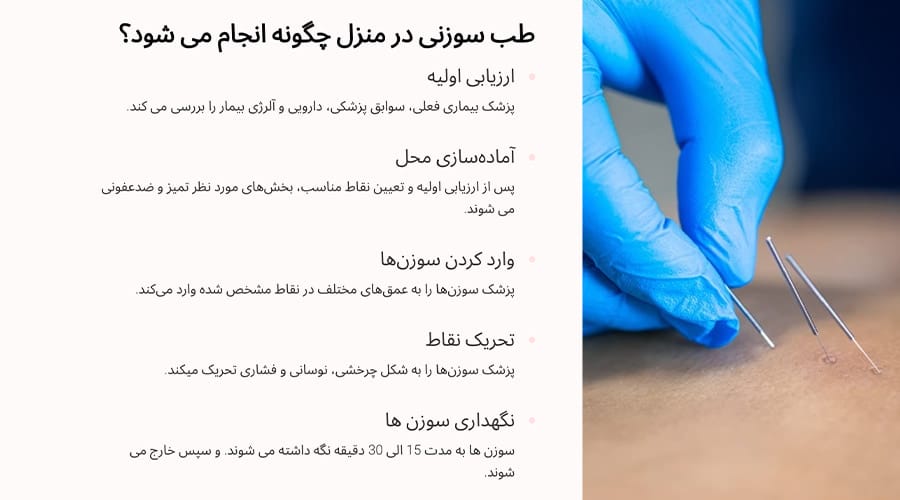 متخصصین مرکز یارا درمان فرآیند طب سوزنی در منزل چگونه انجام می دهند؟