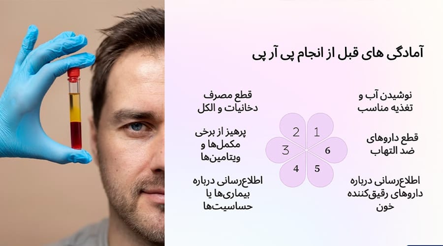 آمادگی های قبل از انجام پی آر پی ( PRP )