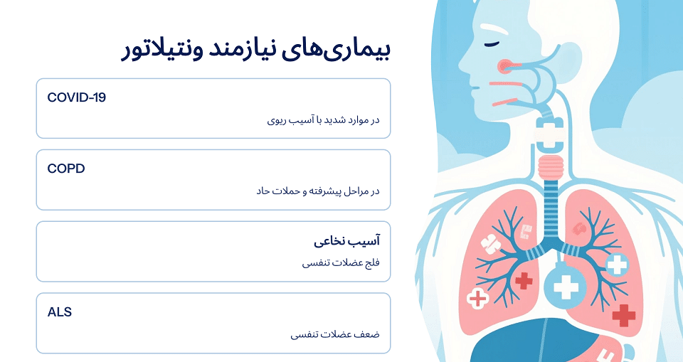 چه افرادی به اجاره ی ونتیلاتور نیاز دارند
