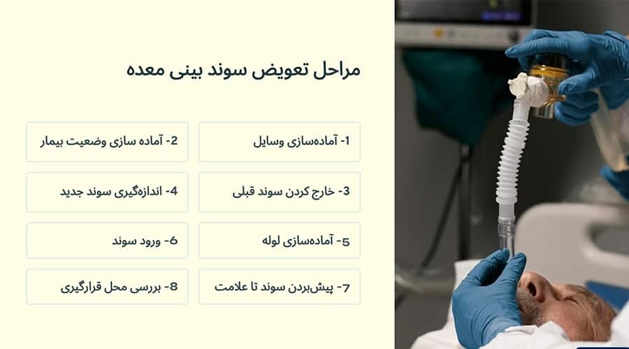 مراحل تعویض سوند بینی معده