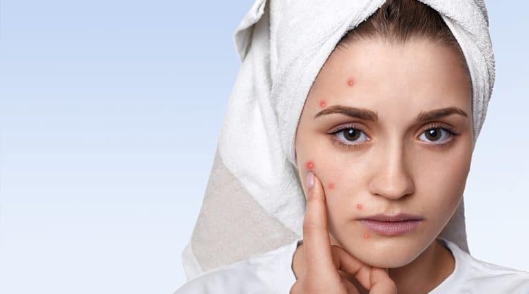 بیماری‌های پوستی ناشی از آلودگی هوا و روش‌های درمان